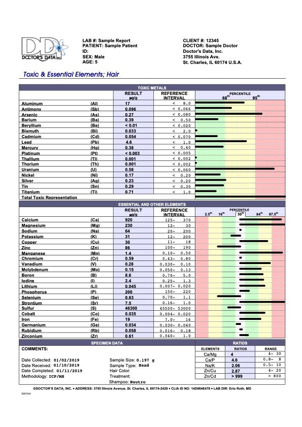 Heavy Metal Hair Mineral Analysis
